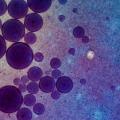 Biofilm and Human Health: The Hidden Threat & How to Detect It