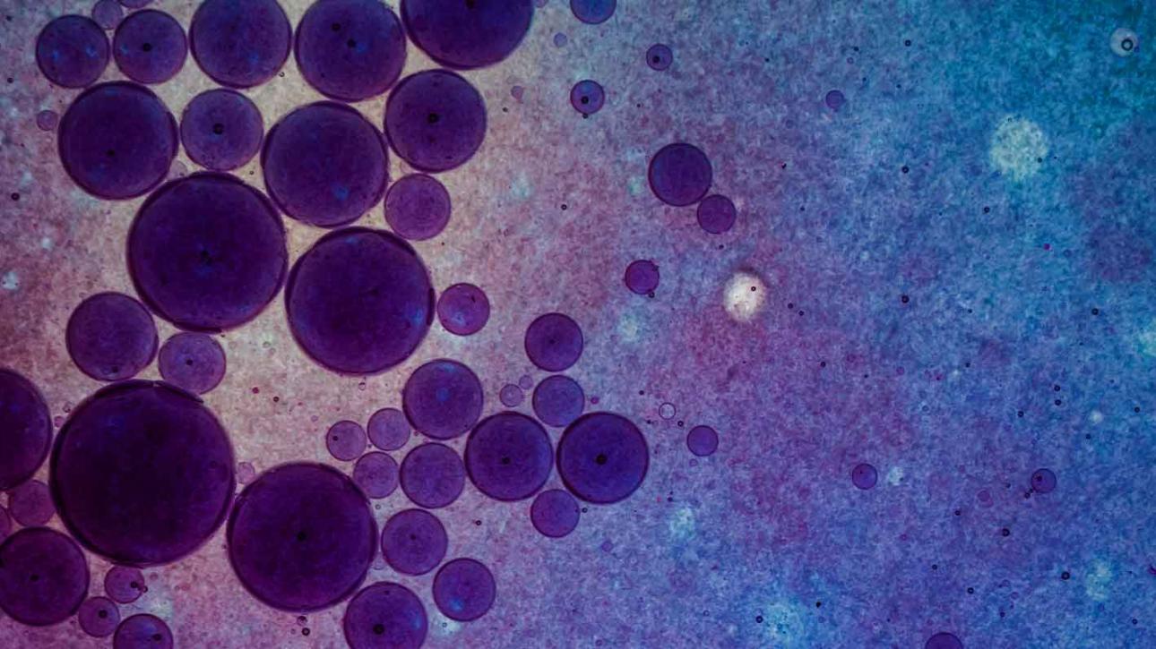 Biofilm And Human Health The Hidden Threat & How To Detect It